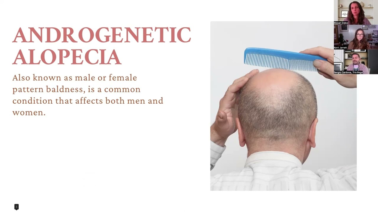 #thehairwire #malepatternhairloss #femalepatternhairloss #androgenetic 

Male or Female Pattern Hair Loss, also known as androgenetic alopecia, is a common form of hair loss that affects millions of people worldwide. It is characterized by a progressive thinning of hair on the scalp, and in some cases, a receding hairline and bald spots.

In this informative video, we delve into the causes, symptoms, and treatment options for male or female pattern hair loss. We'll explore the role of genetics and hormones in the development of this condition, as well as the various lifestyle factors that can contribute to hair loss.

We'll also discuss the different treatment options available, including topical and oral medications, hair transplant surgery, and other innovative therapies. We'll hear from experts in the field of hair loss and learn about the latest research and advancements in the treatment of male or female pattern hair loss.

Whether you are someone who is experiencing hair loss or simply want to learn more about this common condition, this video is a must-watch. Join us as we provide valuable insights and resources for those who need it most and offer hope and encouragement to those who may be struggling with hair loss.