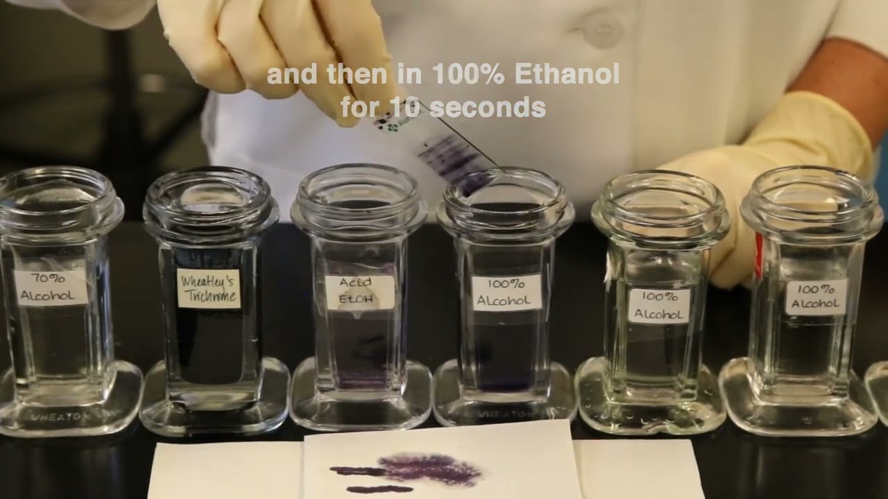 Wheatley's Trichrome Staining