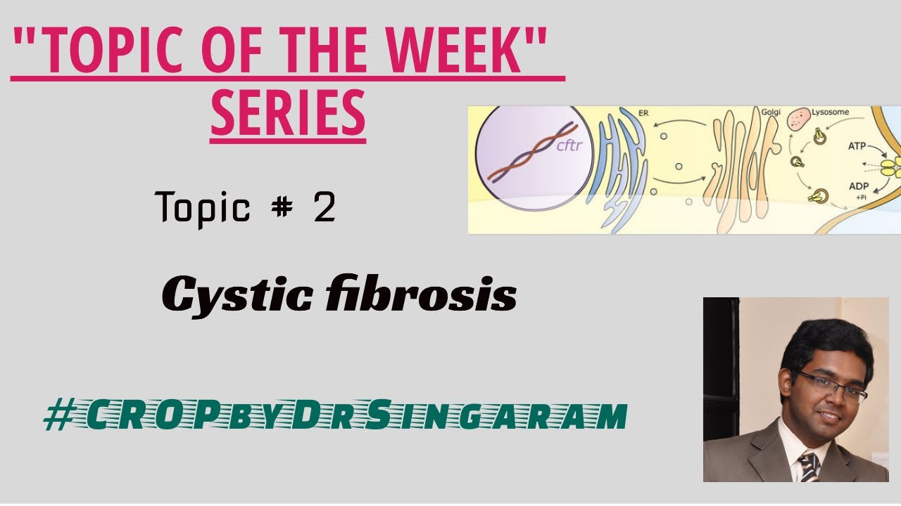 Cystic fibrosis -  Topic of the week series II Topic # 2