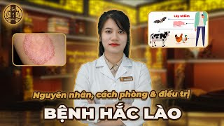 HẮC LÀO - Nguyên nhân cách phòng & điều trị mà bạn phải biết