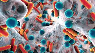 Cleaning and Sanitizing   Foodservice Trim pt1