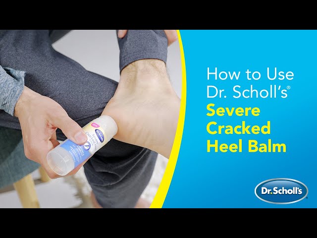I Tried Dr. Scholl's Severe Cracked Heel Balm - YouTube