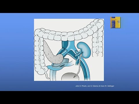 Current Status of Pancreas Versus Islet Transplantation