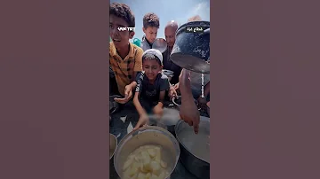 طفولة ذابلة ومتعبة بسبب الجوع والحرب 