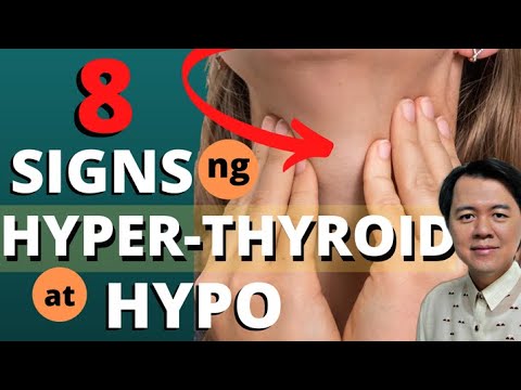 8 Senyales ng Sakit sa THYROID: Hyper o Hypo-thyroid - Payo ni Doc Willie Ong #469b