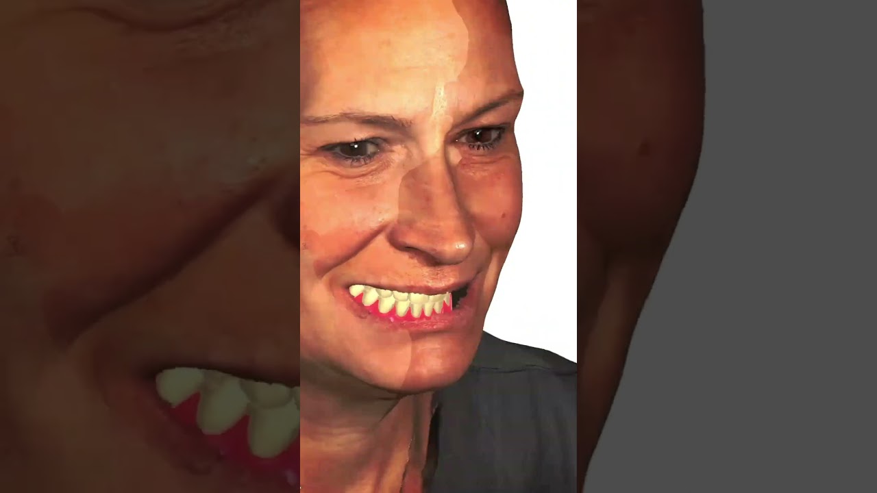 New Ivoclar Printed Denture material