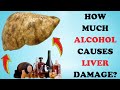 Warning signs how alcohol affects liver health  healthy care