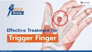 Effective Treatment for Trigger Finger | Vejthani's Scoop