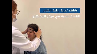 زراعة الشعر للنساء في مشفى اليت هير