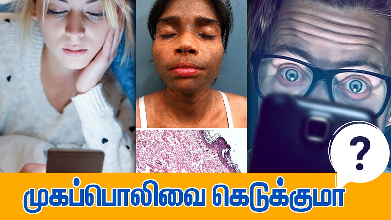 இரவில் செல்போன் நோண்டுவதால் முகத்திற்கும் கேடு GEM TV mobile 