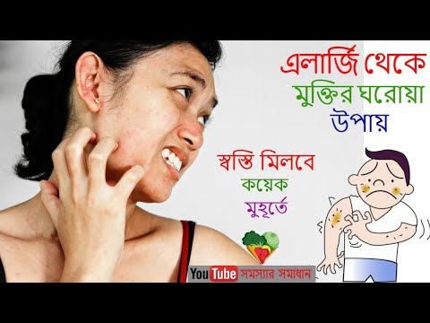 এলার্জি থেকে মুক্তির উপায়/এলার্জি থেকে মুক্তি মিলবে মাত্র ১ ঘন্টায়/#সমস্যারসমাধান