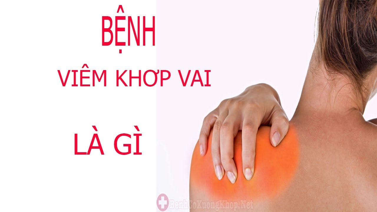 bệnh viêm khớp vai là gi-những ai sẽ hay mắc bệnh này