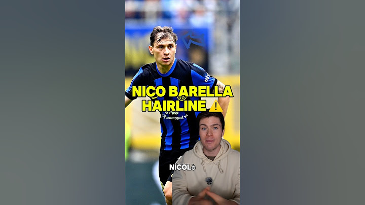 NICO BARELLA’S HAIRLINE IS BACK! ⚠️