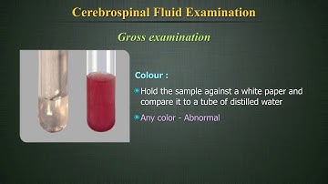 Cerebrospinal Fluid Examination (CSF)
