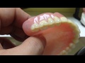 denture  Зубные протезы с замками и фрезеровкой