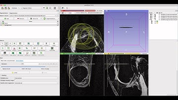 aevaSlicer: Grow from Seeds Segmentation