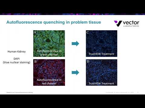 Video: Hoe om agtergrondkleuring in immunofluoressensie te verminder?
