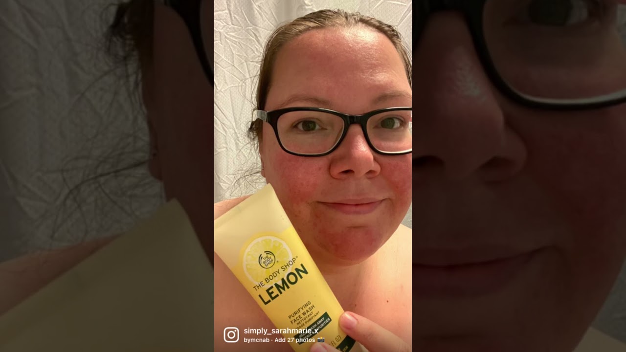 I suffer with Rosacea, this is my journey so far. More detailed video coming soon 