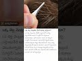 Do You Think White Will Come Because Of This Silly Thing 🤔🤔🤔 || #healthtips #whitehairtiblackhair 🤔🤔