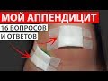 МОЙ АППЕНДИЦИТ. КАК ВСЁ БЫЛО. 16 ВОПРОСОВ И ОТВЕТОВ. СИМПТОМЫ АППЕНДИЦИТА #healthy_help