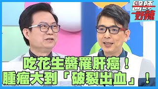 7旬翁吃數10年花生醬罹肝癌！腫瘤大到「破裂出血」嚇壞醫！【#醫師好辣】歸家豪 陳欣湄 洪暐傑 主題特映版