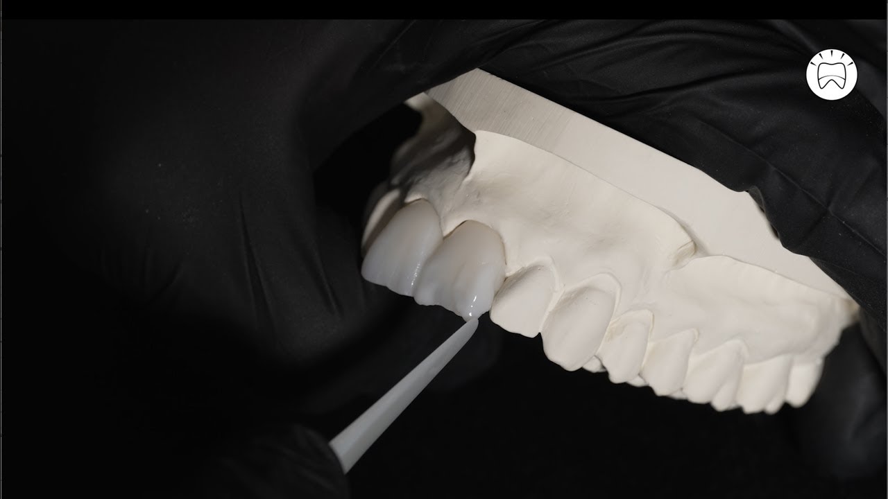 HeraCeram cre-active - Tutorial - Aesthetic Bleach Concept