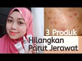 3 Produk untuk hilangkan parut jerawat (Menjadi!)