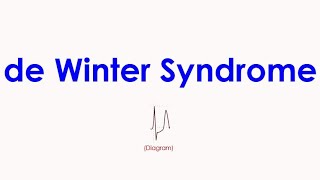 de Winter Syndrome (ECG Pattern)