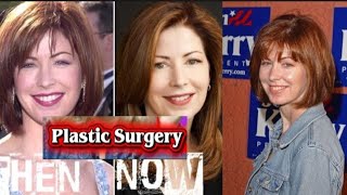 Dana Delany Plastic surgery Cited in some “disaster” roundups.