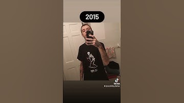 Thumbnail of Lil Peep Throughout The Years🕊️(2012-2017)Rest in Peace🙏#rip