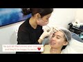 Getting Forehead Botox &amp; Yellow Laser at 21!