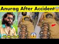 😱THE UK07 RIDER After the Accident....| Anurag dobhal health Update | THE UK07 RIDER NEWS