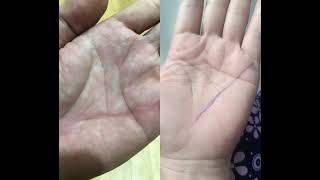 Xem Chỉ Tay: Đường Sức Khỏe - Đông Phù, Tây Trợ .