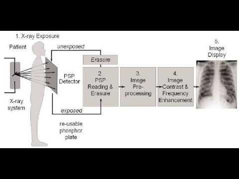 Initial or Routine Procedures or Steps in Radiography - YouTube