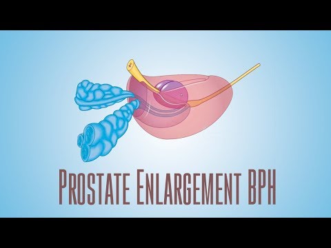 Video: Vnetje Prostate In Abscesi Prostate Pri Belih Dihurjih