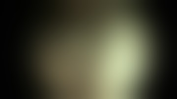 Anatomic ACL Reconstruction