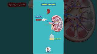 خطورة احتباس السوائل فى الجسم