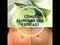 Cómo eliminar y prevenir las estrías con aloe vera/sábila