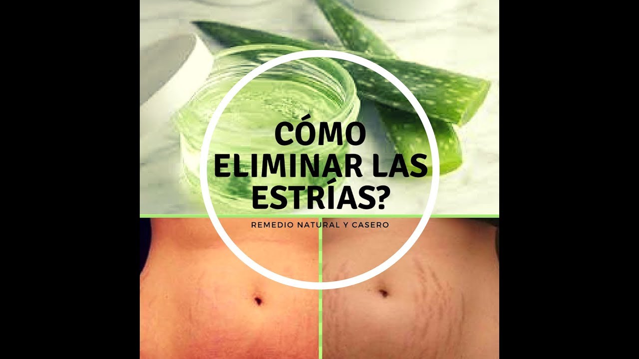 Cómo eliminar y prevenir las estrías con aloe vera/sábila - YouTube