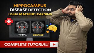 Hippocampus Disease Detection using Machine Learning | Python Projects for Final Year Students