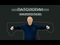 Патологии малого таза.Доктор Кириллов.