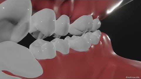 Group function occlusion