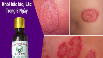 Thuốc chữa dứt điểm 100%  hắc lào, lác đồng tiền Nhà thuốc Nguyễn thi