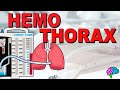 Hemothorax Video Lesson Quiz