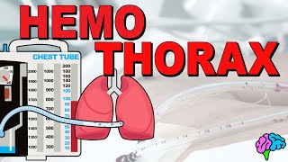 What is a Hemothorax? EXPLAINED!