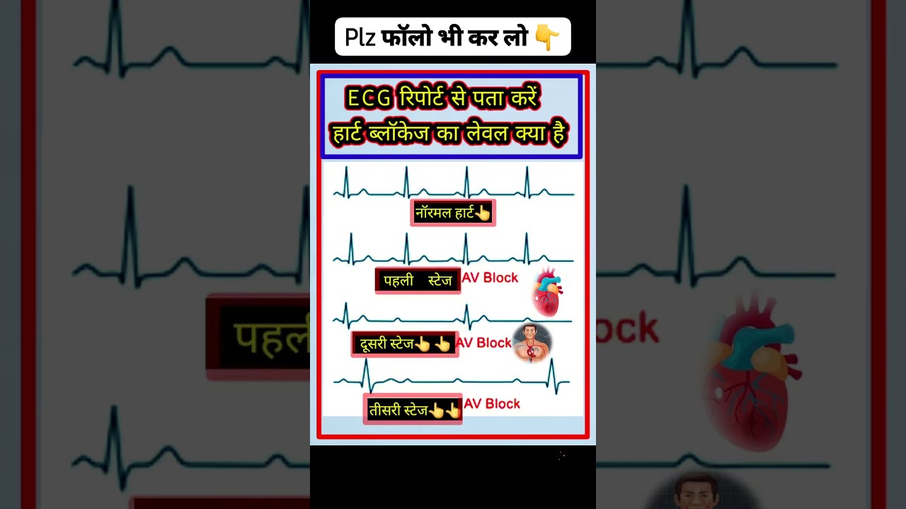 ECG Report stage 