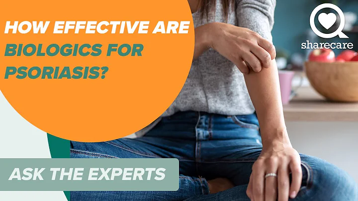 How Effective are Biologics for Psoriasis? | Ask the Experts | Sharecare