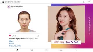 Korean plastic surgery real before and after pictures