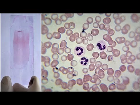 Blood Smear Preparation and Staining Practical Lab