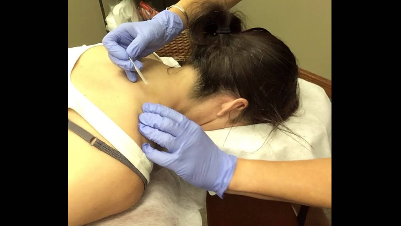 Do injections for neck pain work immediately?